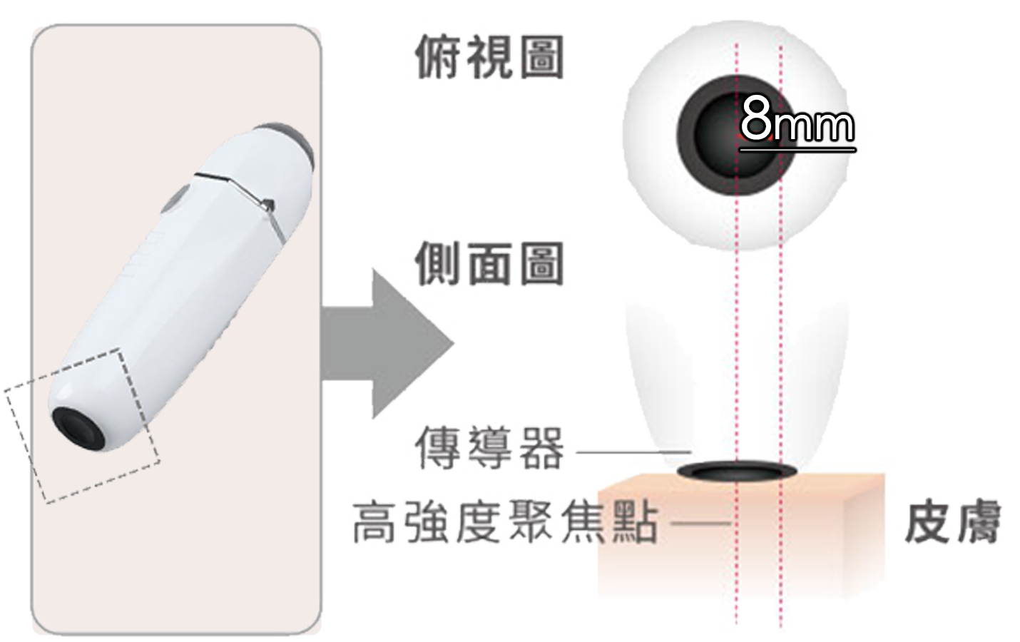 Liftera 頭