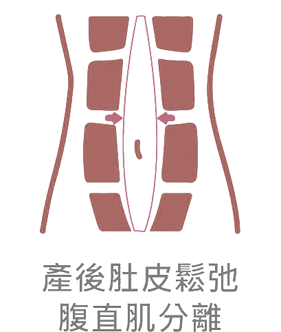 肌緊30-4