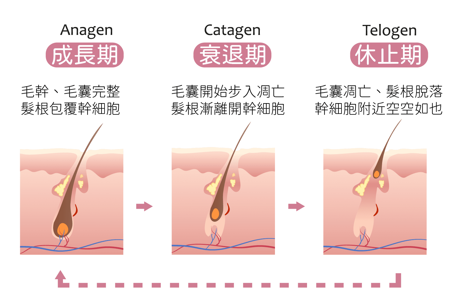 脫毛