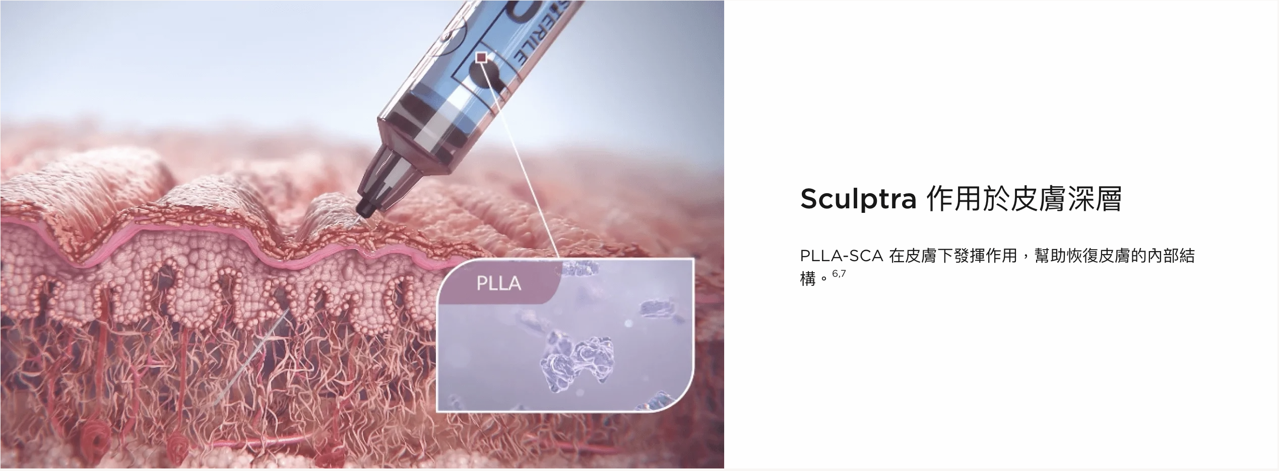 sculptra®塑然雅-1