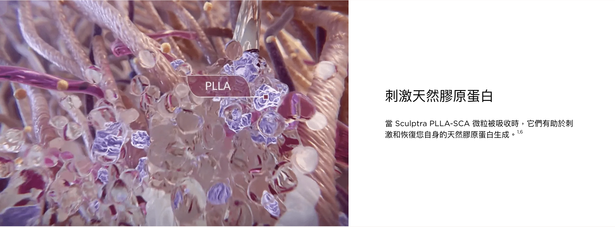 sculptra®塑然雅-2