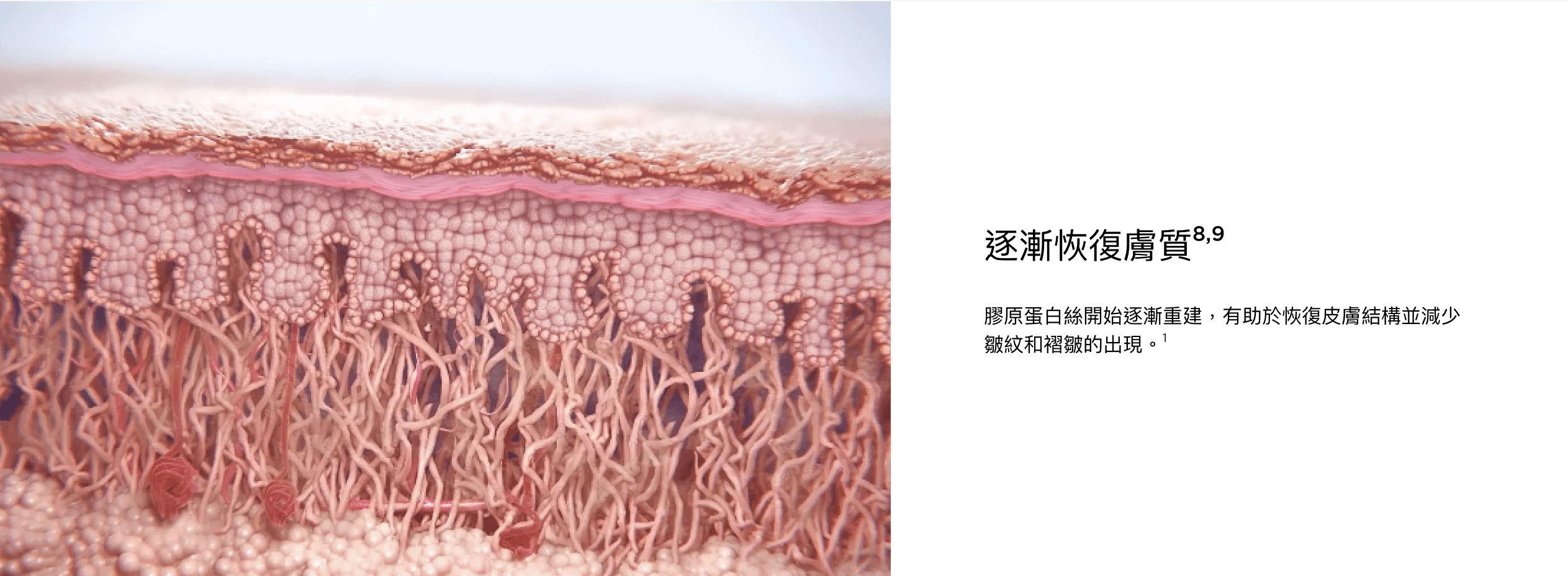sculptra®塑然雅-3